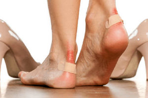 درمان تاول پا با ۹ روش خانگی سریع