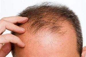 طرز تهیه معجونی با استفاده از "حنا و روغن کنجد" برای درمان ریزش و سفیدی مو