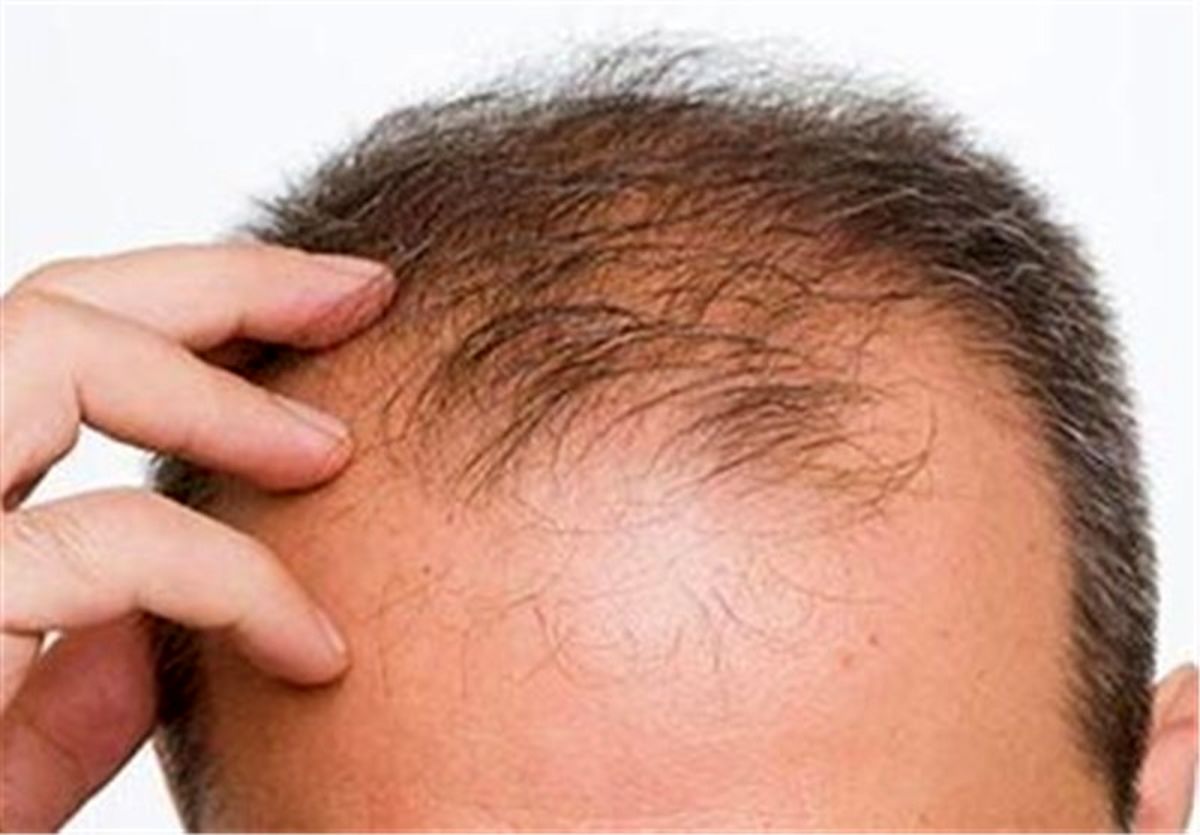 طرز تهیه معجونی با استفاده از "حنا و روغن کنجد" برای درمان ریزش و سفیدی مو