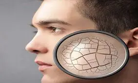 تشخیص کمبود ویتامین از روی صورت!