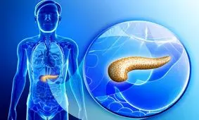 علائم سرطان لوزالمعده چیست؟+ رژیم غذایی مخصوص