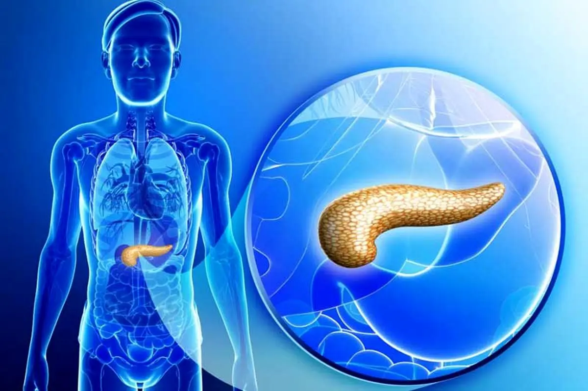 علائم سرطان لوزالمعده چیست؟+ رژیم غذایی مخصوص