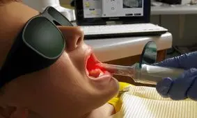 تولید محلول ضدعفونی کننده کانال دندان در زمان عصب‌کشی