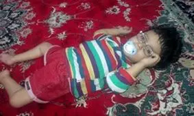 « امیر محمد» کودکی که آب جمجمه‌اش بند نمی آید! + تصویر