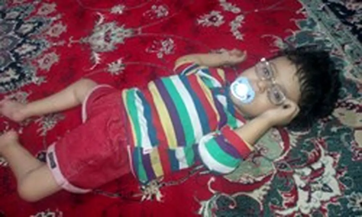 « امیر محمد» کودکی که آب جمجمه‌اش بند نمی آید! + تصویر