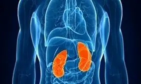 نقش مصرف «کافئین» در بروز سنگ کلیه