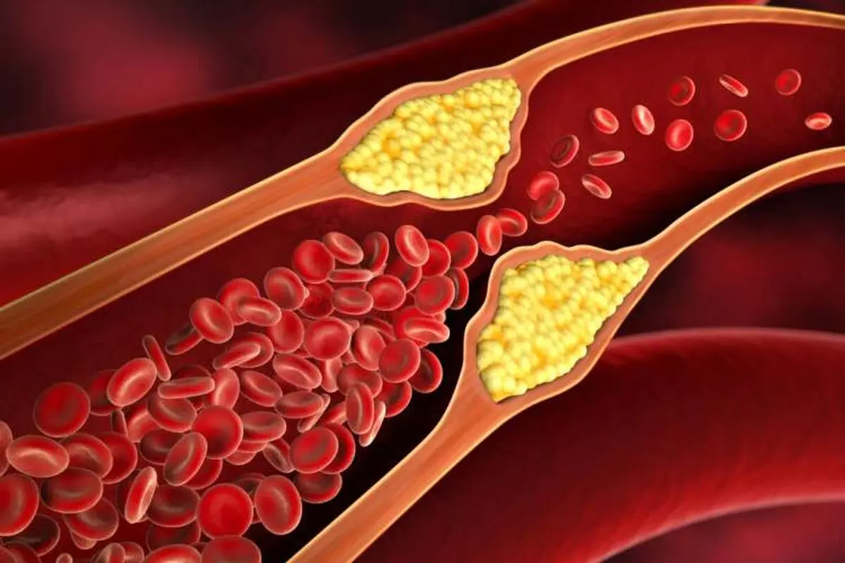 ماده غذایی که رگ‌های بسته بدن شما را باز می‌کند!