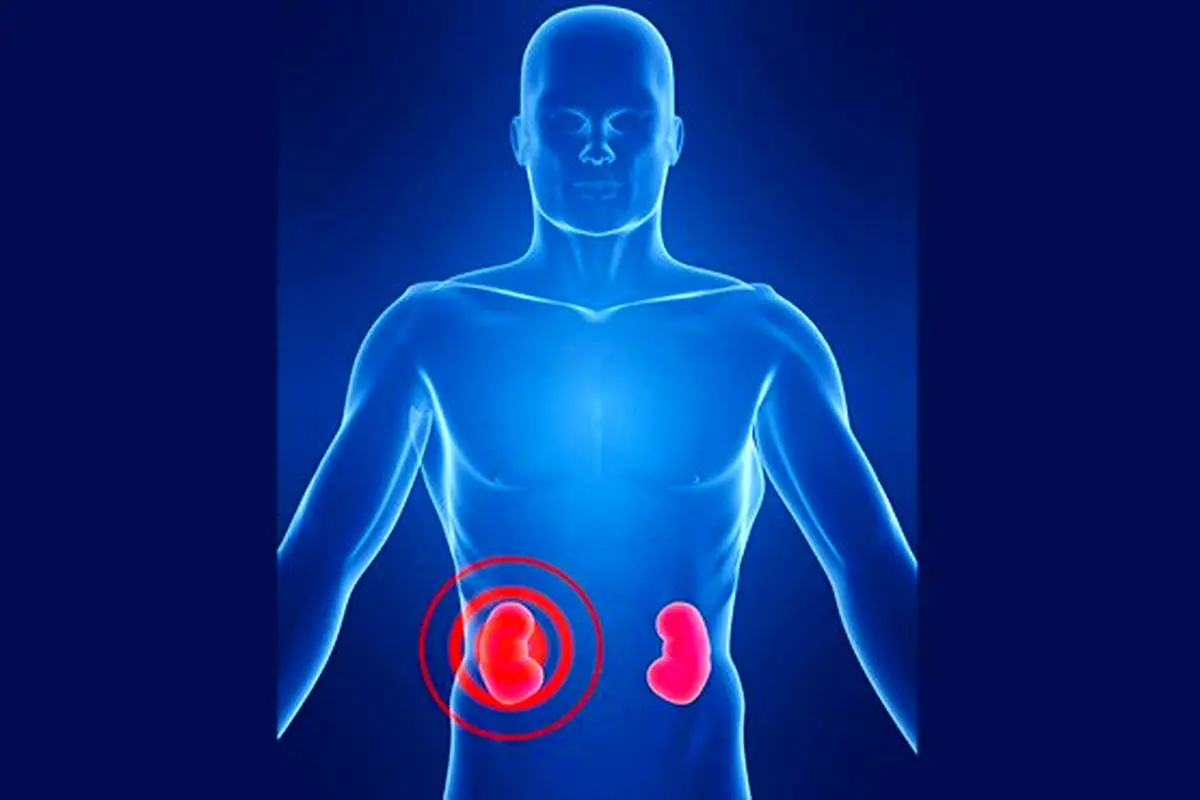 ژن درمانی بیماری‌های کلیوی مزمن