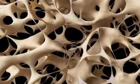 تولید نانوداربست‌های استخوانی هیدروژلی با فناوری نانو