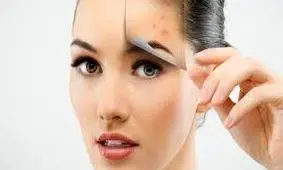 درمان معجزه آسا برای جوش صورت