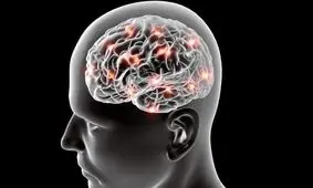 ارتباط خواب آلودگی در طول روز با آلزایمر