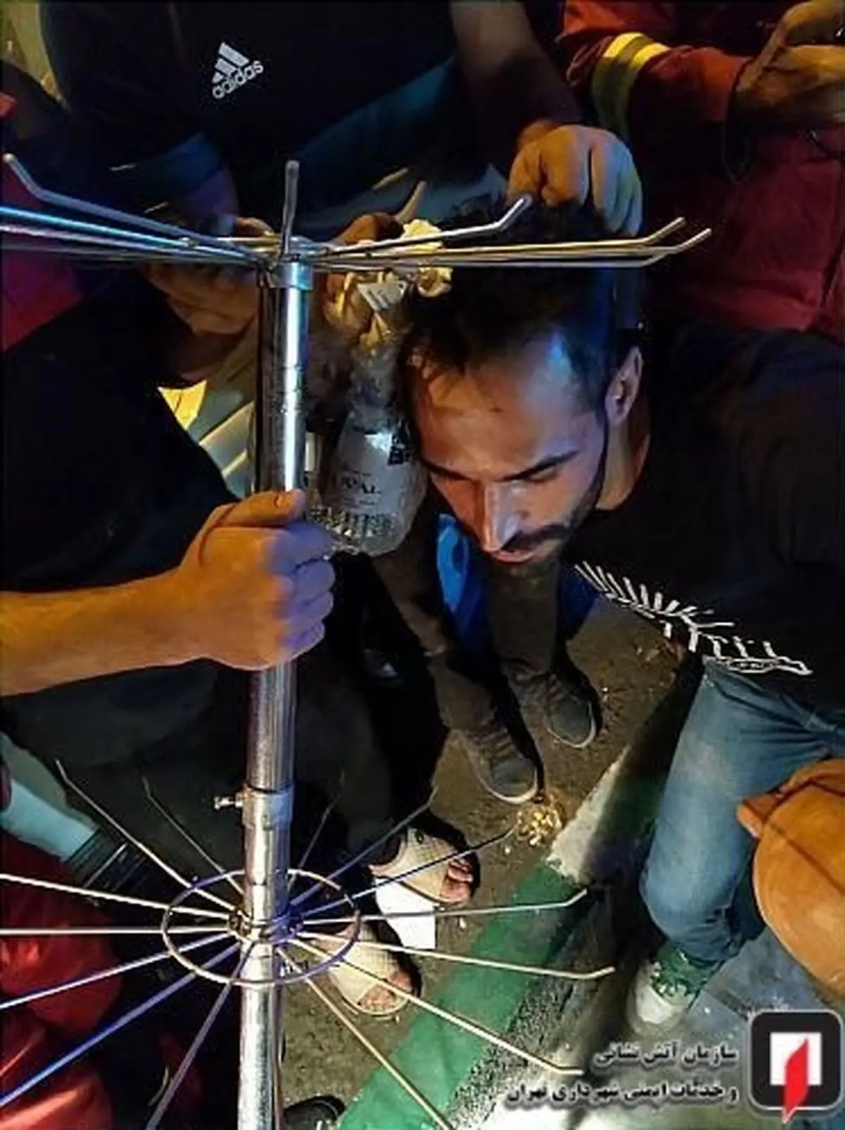 فرو رفتن عجیب میله رخت‌آویز در سر مرد جوان + تصاویر