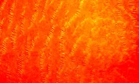 دلیل ترک خوردگی پوست بدن را بدانید!