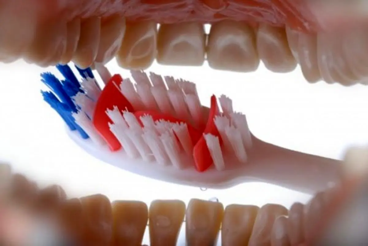 افزایش خطر مرگ با مسواک نزدن!