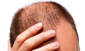 امیدی جدید برای درمان ریزش مو/ رشد دوباره مو با کمک نور LED