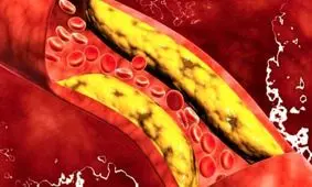 بهترین روش برای اندازه گیری چربی خون در خانه