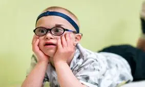 دستاورد جدید دانشمندان ژاپنی/ حذف کروموزوم عامل سندرم داون از سلول‌های انسانی