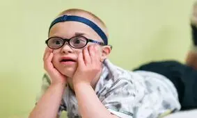 دستاورد جدید دانشمندان ژاپنی/ حذف کروموزوم عامل سندرم داون از سلول‌های انسانی