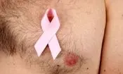 ۶ روش‌ تشخیص سرطان سینه در آقایان