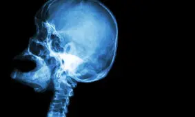 نجات کودک آمریکایی پس فرو رفتن سیخ در سرش