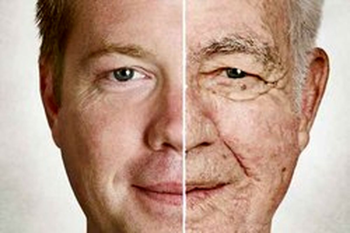۶ هشدار غذایی برای دورماندن از چین وچروک های پوست