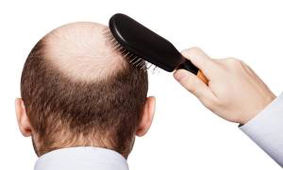 عطری خوش‌بو که جلوی ریزش موهایتان را می‌گیرد!