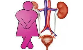 عفونت ادراری + علایم + پیشگیری + درمان