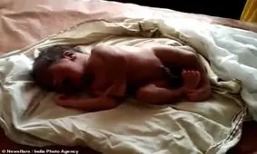 تولد نوزاد عجیب الخلقه با 4 پا + تصاویر