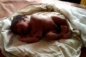 تولد نوزاد عجیب الخلقه با 4 پا + تصاویر