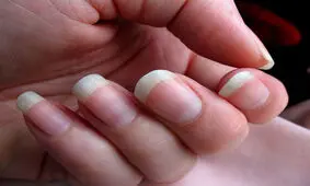 ناخن‌ها درباره سلامتی شما چه می‌گویند؟
