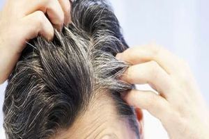 برای جلوگیری از سفیدی مو باید چه کارهایی انجام دهیم؟