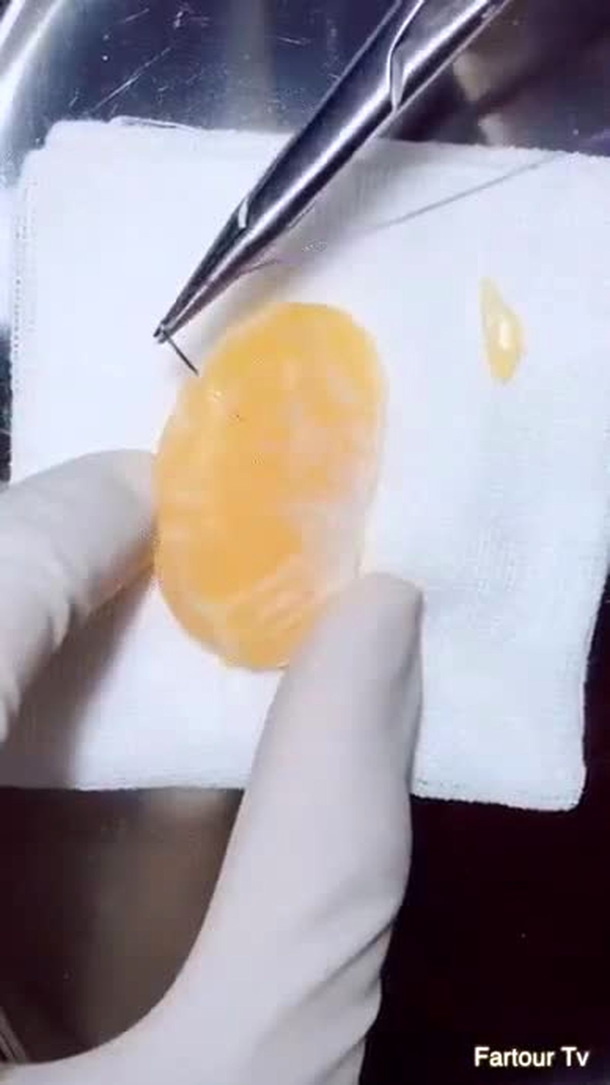 استفاده از نارنگی در تمرین جراحی کلیه!