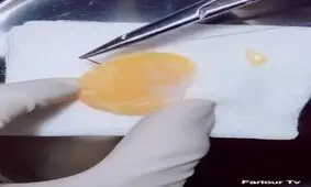 استفاده از نارنگی در تمرین جراحی کلیه!