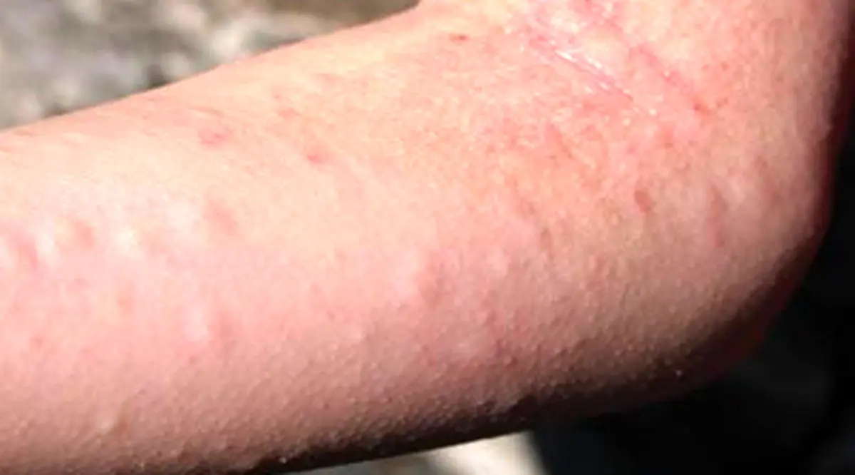 هشدارهای تغذیه در مورد چین و چروک‌های پوستی