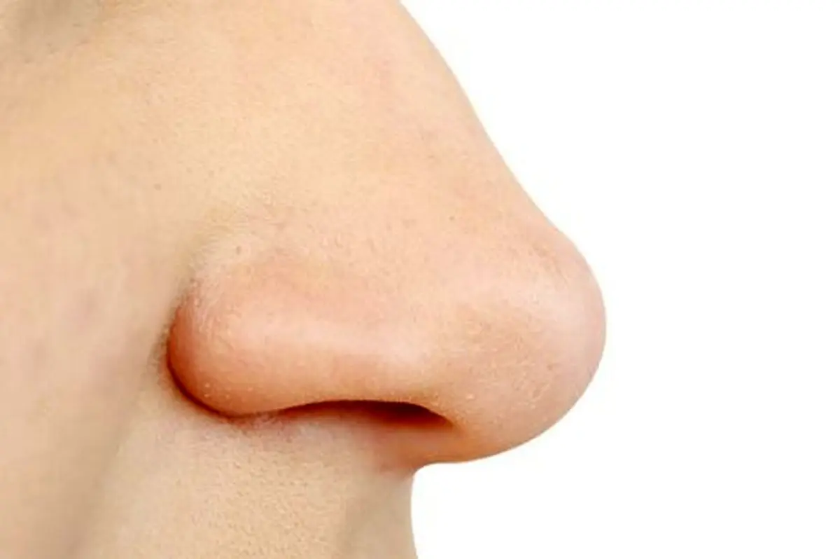 بوی بیماری بر افراد سالم تاثیر می‌گذارد