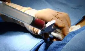 اولین پیوند مغز استخوان بر روی بیمار تالاسمی در تبریز با موفقیت انجام شد