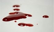 انتقام جویی از پدر و پسر با چاقو و اسید