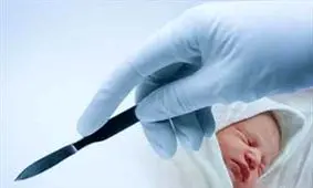 افزایش آمار سزارین در تاریخ‌های خاص