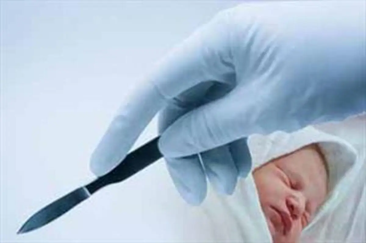 افزایش آمار سزارین در تاریخ‌های خاص