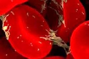 ۶ نشانه هشداردهنده که خبر از وجود لخته خون دربدن شما می‌دهد