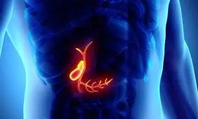 آیا بدون کیسه صفرا می توان زندگی کرد؟