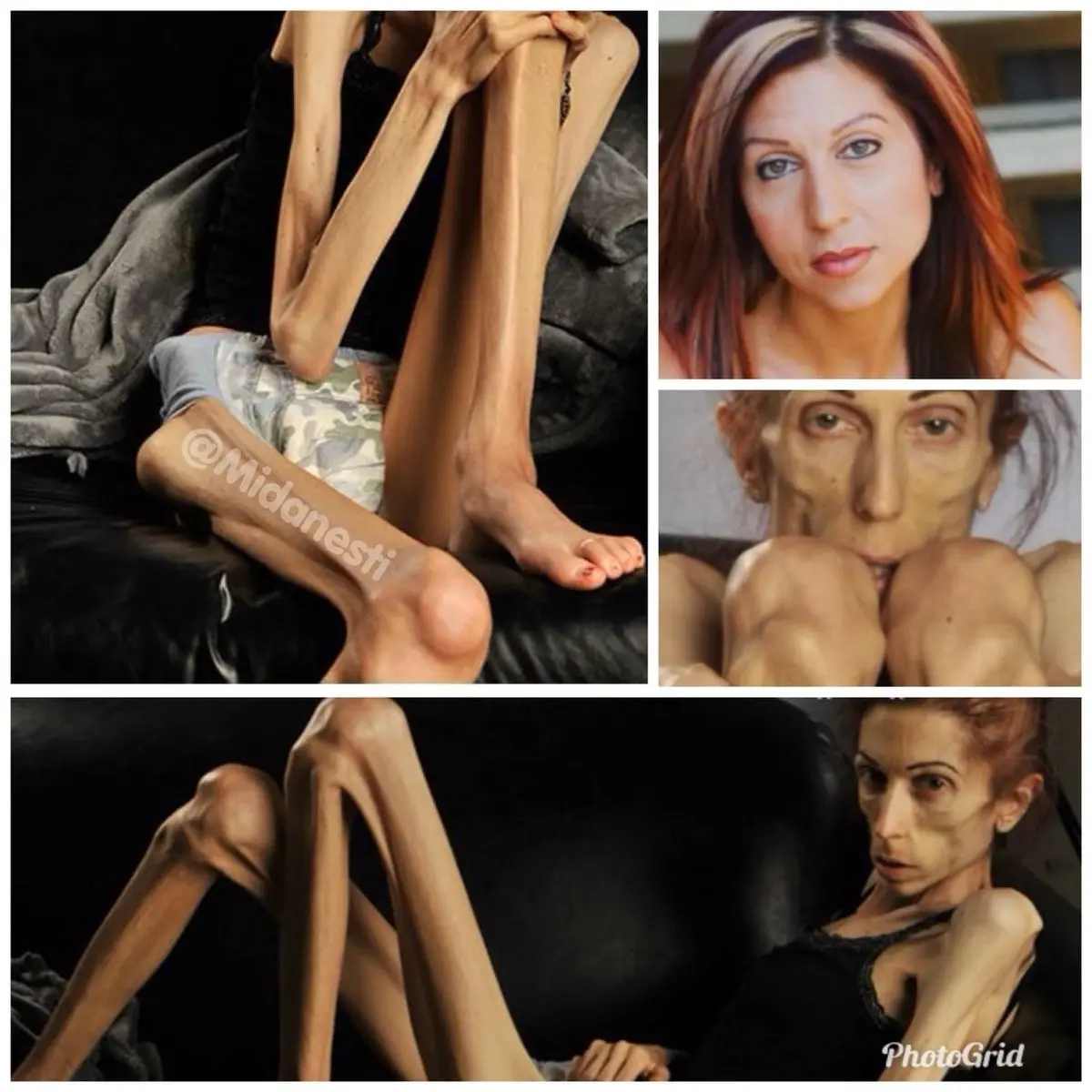 جنون لاغری!