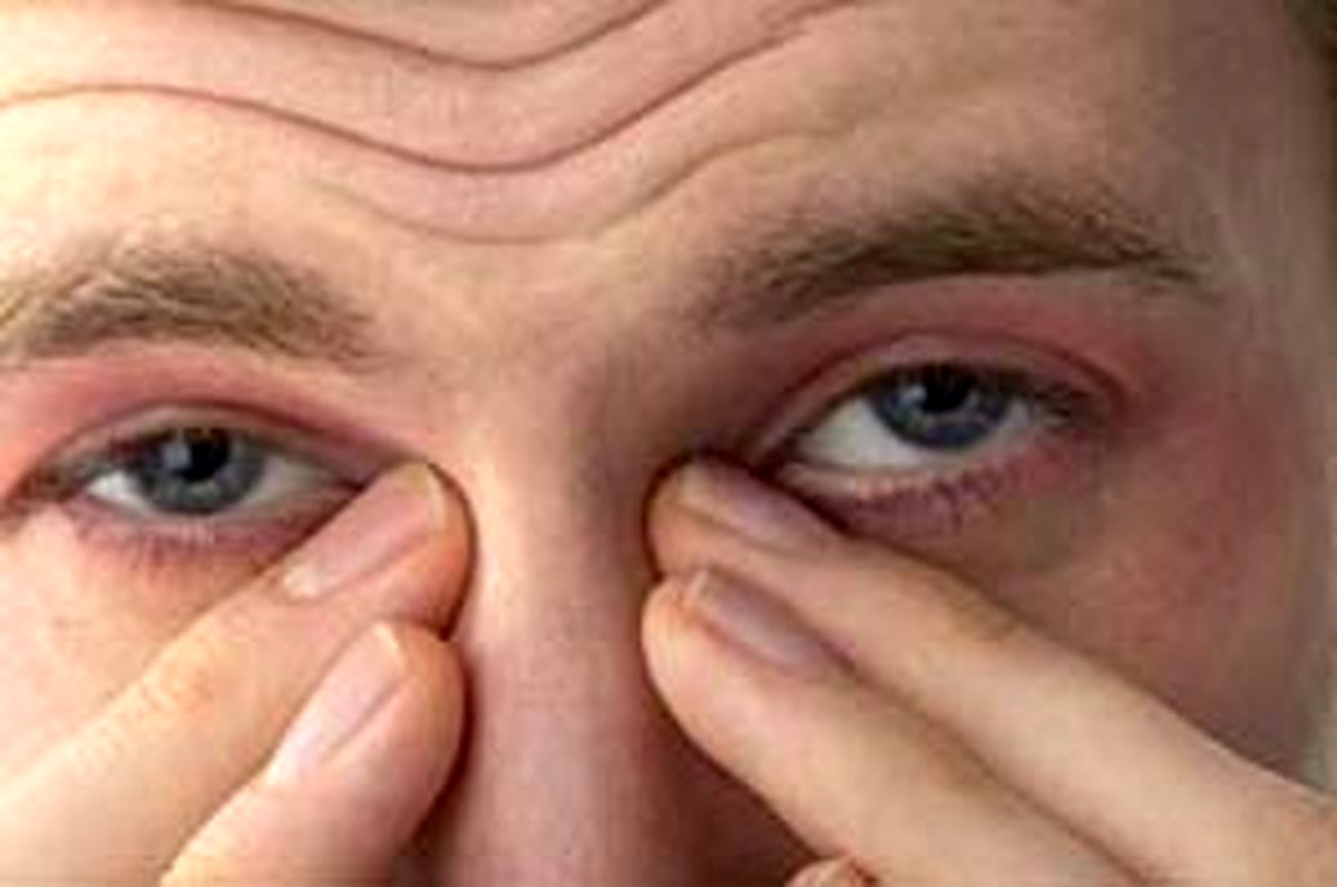 علل ایجاد سیاهی دور چشم چیست + راه درمان