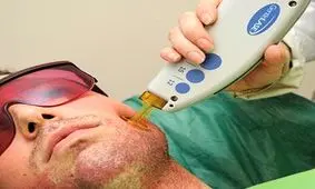 همه چیز درباره استفاده از لیزر مو‌های زاید/ چه کسانی نباید از لیزر استفاده کنند؟