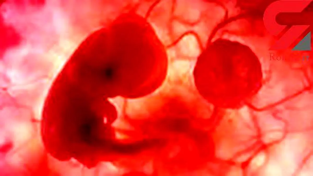 تولد نوزادی که 15 سال طول کشید تا به دنیا بیاید!