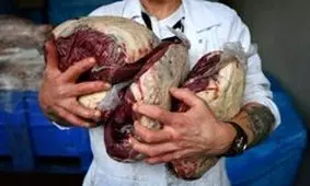 ماده غذایی که خطر ابتلا به سرطان سینه را افزایش می‌دهد