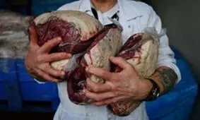 ماده غذایی که خطر ابتلا به سرطان سینه را افزایش می‌دهد