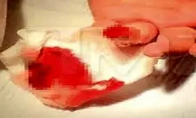 قطع کردن انگشت مدیر مدرسه توسط ولی دانش آموز در خراسان