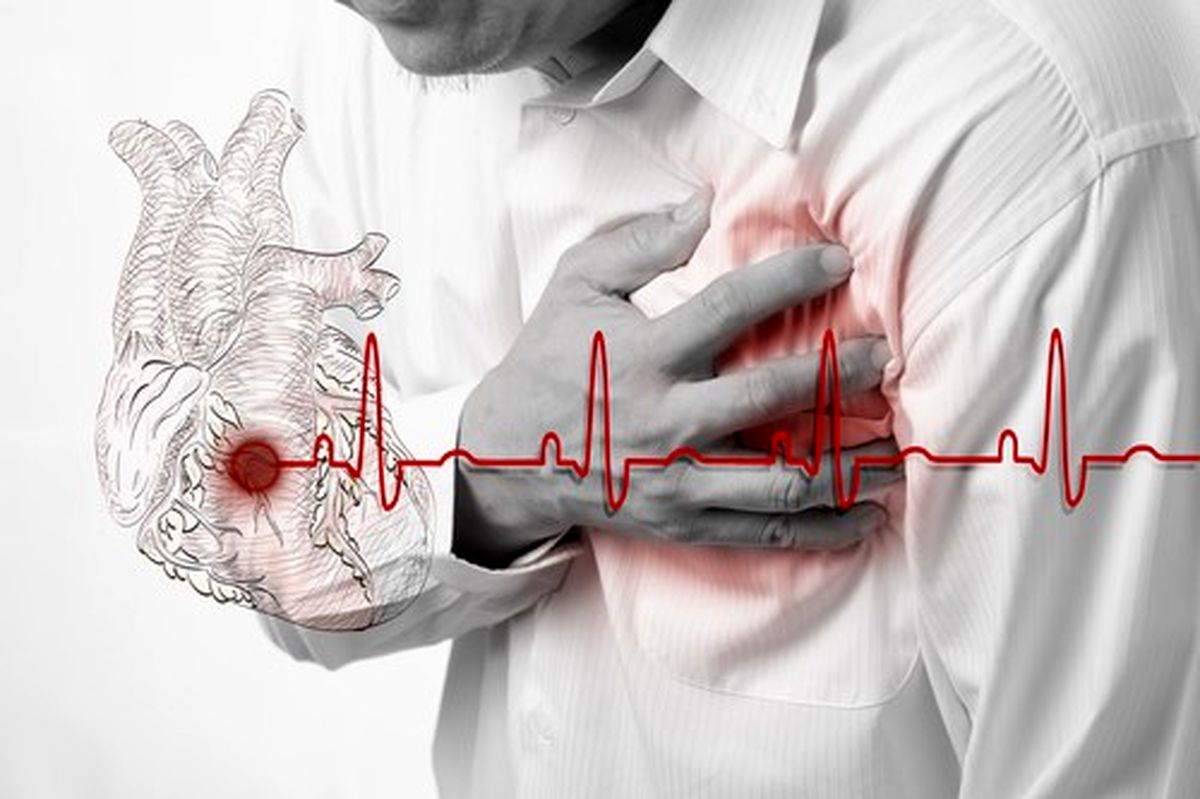 چرا روزانه قلب 300 ایرانی میایستد؟