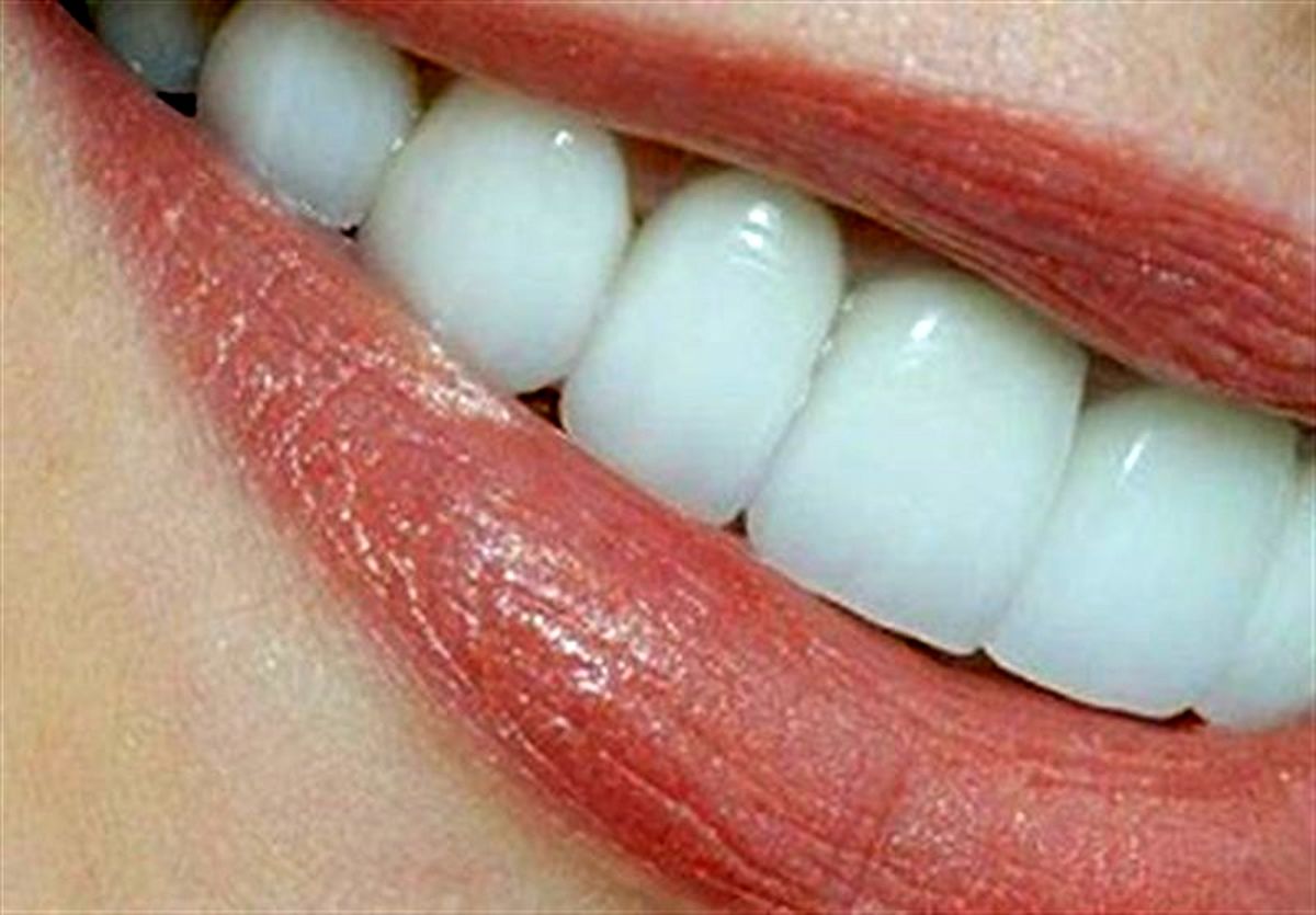 طب سنتی | یکی از رموز بزرگ "سلامت دندانها" که شما نمیدانید